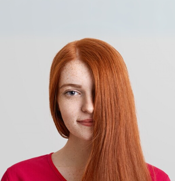 Pattern Baldness in Women